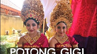 POTONG GIGI?! #CVLOG5