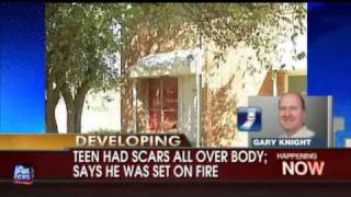 Black boy locked in closet for four years