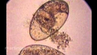 Fasciola hepatica (Eclosión de huevo)