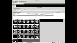 Linux Mint prueba de software open source para Dicom.-