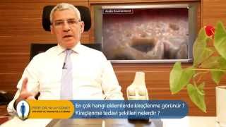 En çok hangi eklemlerde kireçlenme görünür? Kireçlenme tedavi şekilleri - Prof. Dr. Nejat Güney