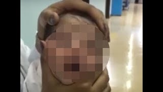 Saudi nurses sacked for squashing baby's head