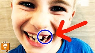 IT'S LOOSE! HobbyFrog Shares His Tips by HobbyFamilyTV