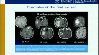 Neuroimaging Predictors of Survival, Pathology, and Molecular Profiles... - David Gutman