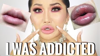 STORYTIME: I WAS ADDICTED TO LIP FILLER
