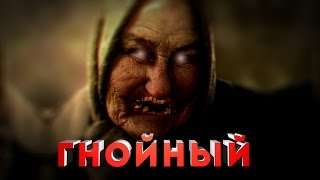 СТРАШНЫЕ ИСТОРИИ - ГНОЙНЫЙ