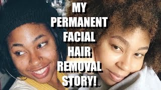 MY PERMANENT LASER HAIR REMOVAL FACE STORY & 7 YEAR EXPERIENCE