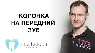 #Стоматолог Стас Белоус #КОРОНКА НА ПЕРЕДНИЙ ЗУБ