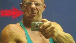 ИШЕМИЧЕСКИЙ ИНСУЛЬТ. НЕВРОЛОГИЯ