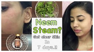 HOW TO GET CLEAR SPOTLESS SKIN.!!!Neem steam.!!