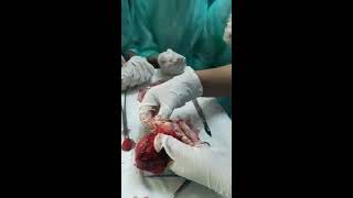 Uterus Specimen Demonstration By Dr Ayesha (URDU)