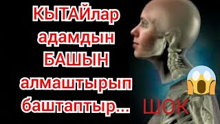 Кытайлар Адамдын БАШЫН алмаштырып баштаптыр...тез коргуло укмуштар тв шумдук видео акыркы кабарлар