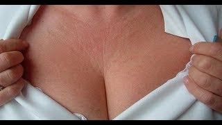 ★Я не прячу декольте под водолазками. Маска из банана и мускусной розы разгладит морщины ниже шеи.