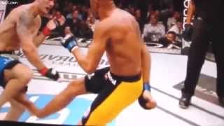 MMA10 - Pain after anderson silva broken leg