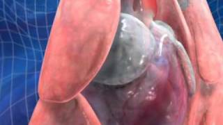 Feline Heartworm Disease
