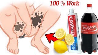 In 7 days, lighten the dark parts of the body, under the arms and legs #skinwhitening