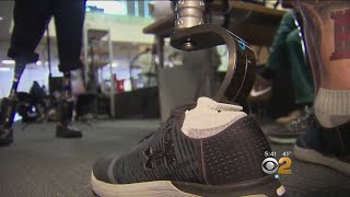 New Ewing Amputation Paves Way For Better Robotic Legs