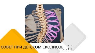 Совет родителям при сколиозе у их детей | Советы врача