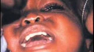 Female Genital Mutilation