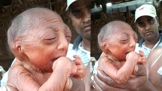 World’s Oldest Sperm Becomes A Baby