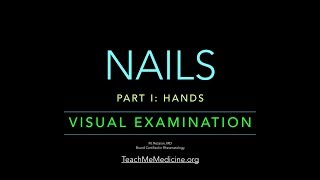 Nails: Visual Examination