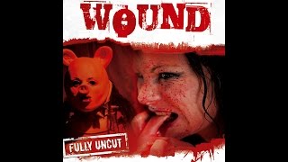 Wound