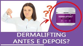 Dermalifting Antes e Depois