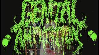 Genital Amputation - Disemboweled Ballsacks