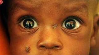 The Starving Chlidren of Africa