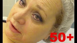 Лицо сползает, волосы выпадают! ЧТО ДЕЛАТЬ? Похудение в 50+ и возрастные изменения