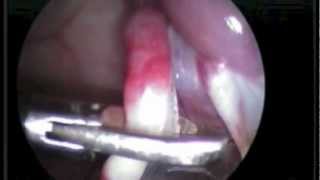 Lap castration 3 month
