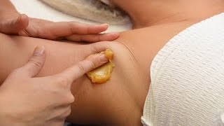 Шугаринг (Sugaring). Депиляция нежелательных волос сахарной пастой