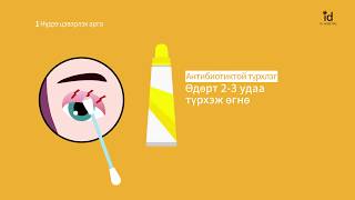 Давхраа хийлгэсний дараа анхаарах зүйлс