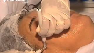 Neurodyn Esthetic Rejuvenescimento Cutâneo 2 - Ibramed