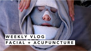 FACIAL, ACUPUNCTURE AND A VAGINA MUSEUM! | Estée Lalonde
