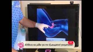 Η Διαδικασία της σπερματέγχυσης - The Process of Insemination