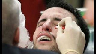 NBA mixed Fight.