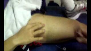 Needle release