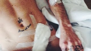 Операция, наркоз - 369 кругов ада. (Последний Vlog).