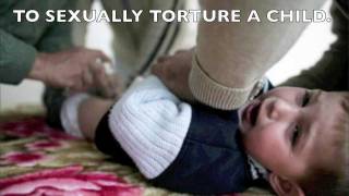 Circumcision FAIL
