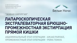 Мастер класс "Живая хирургия": Лапароскопическая экстралеваторная экстирпация прямой кишки