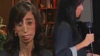 'World's Ugliest Woman' Is Actually Beautiful