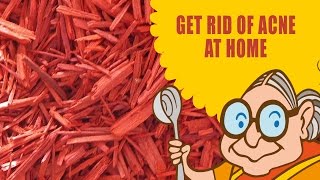 Get Rid of Acne Scars & Pimples - Ayurvedic Natural Home Remedies - Acne Treatment