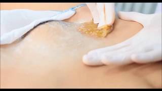 bikini, brazilian, legs, face, compilation cold wax sugaring video