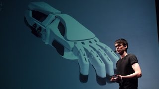 Бионика - способ восстановить возможности человеческого тела