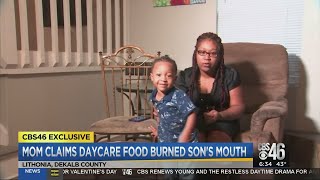 Mom claims daycare burned her 3 year-old son's mouth with hot grits