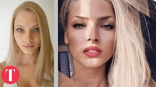 10 Hot Instagram Stars Before Plastic Surgery