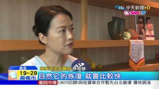 20170414中天新聞　醫療觀光市場大　台灣「美型植髮」吸客