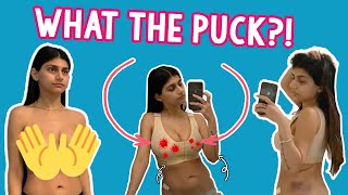 Breast Surgery Revision: Part 1