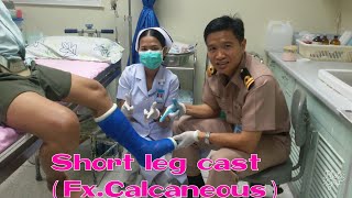 Short leg cast(Fx.calcaneous)by"RAKE"Krittanai
